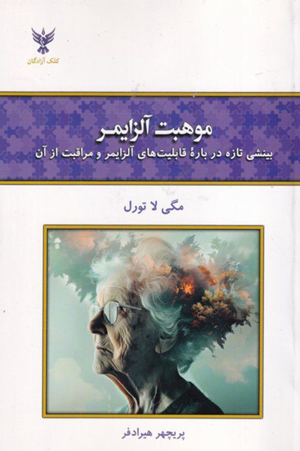 موهبت آلزایمر