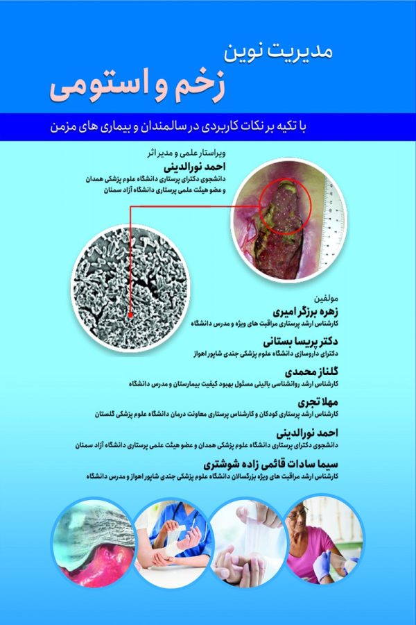 زخم و استومی